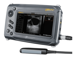BMV™ S6 (Échographe tactile)